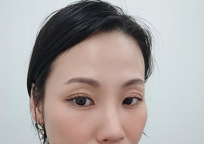 現役ナースの“うっふ～ん”ナイトスター★ライフ　【第十一回｜眉毛もまつげもアゲアゲに♡ 花子、美容医療に手を出し女子力アゲる♡】画像02