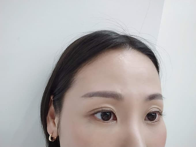 現役ナースの“うっふ～ん”ナイトスター★ライフ　【第十一回｜眉毛もまつげもアゲアゲに♡ 花子、美容医療に手を出し女子力アゲる♡】画像08